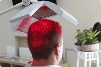 laser hair therapy at McLean VA hair restoration center near Washington DC