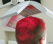 Laser hair loss treatment therapy washington dc mclean virginia