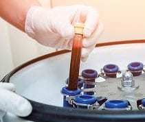 PRP Hair Loss Treatment McLean Virginia Washington DC