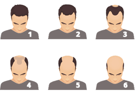 hair transplant evaluation mclean va