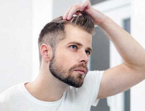 Is DHT the Cause of Your Hair Loss?