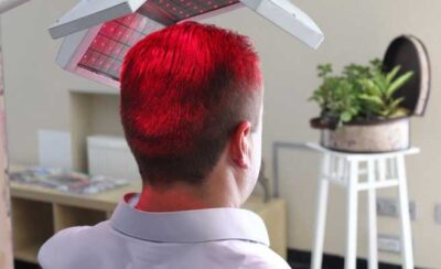 laser hair loss treatment grow your hair back hair restoration clinic