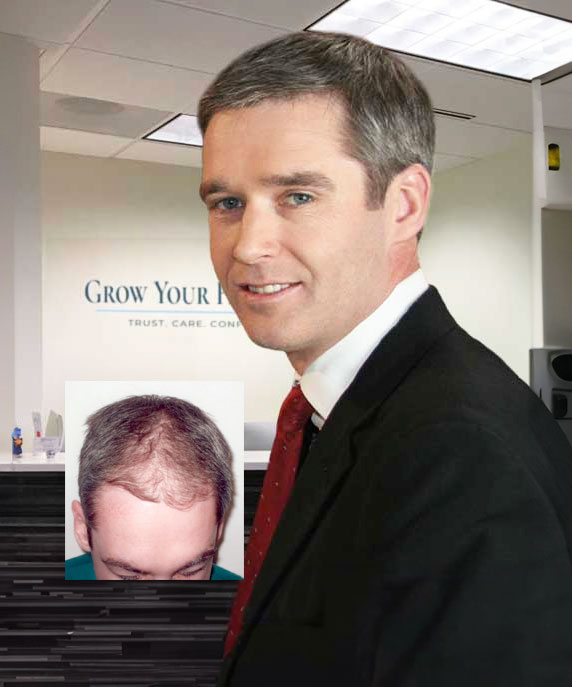 hair transplant clinic doctor mclean virginia